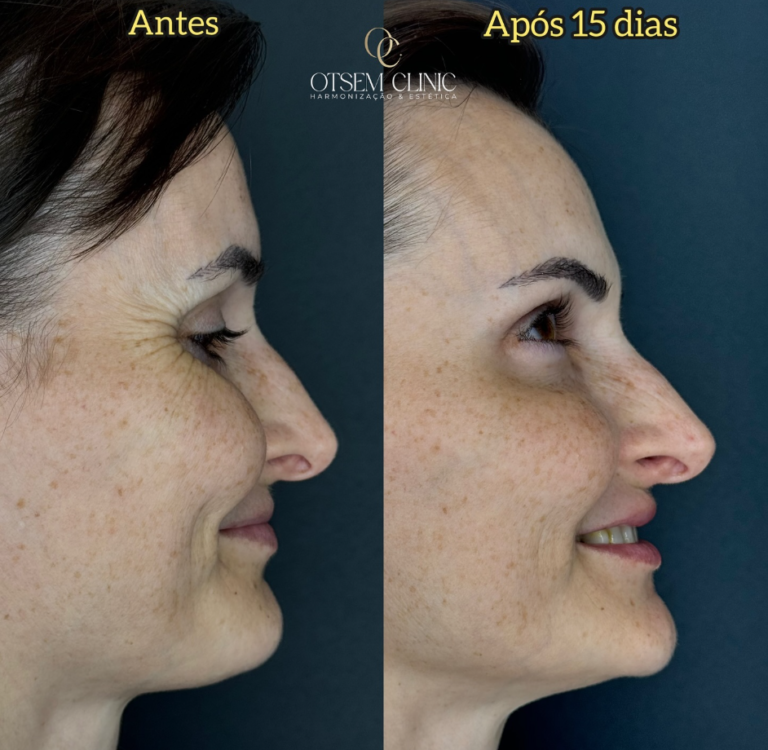 Captura de tela 2026-03-18 152609