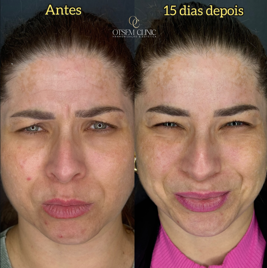 Captura de tela 2026-03-18 152626