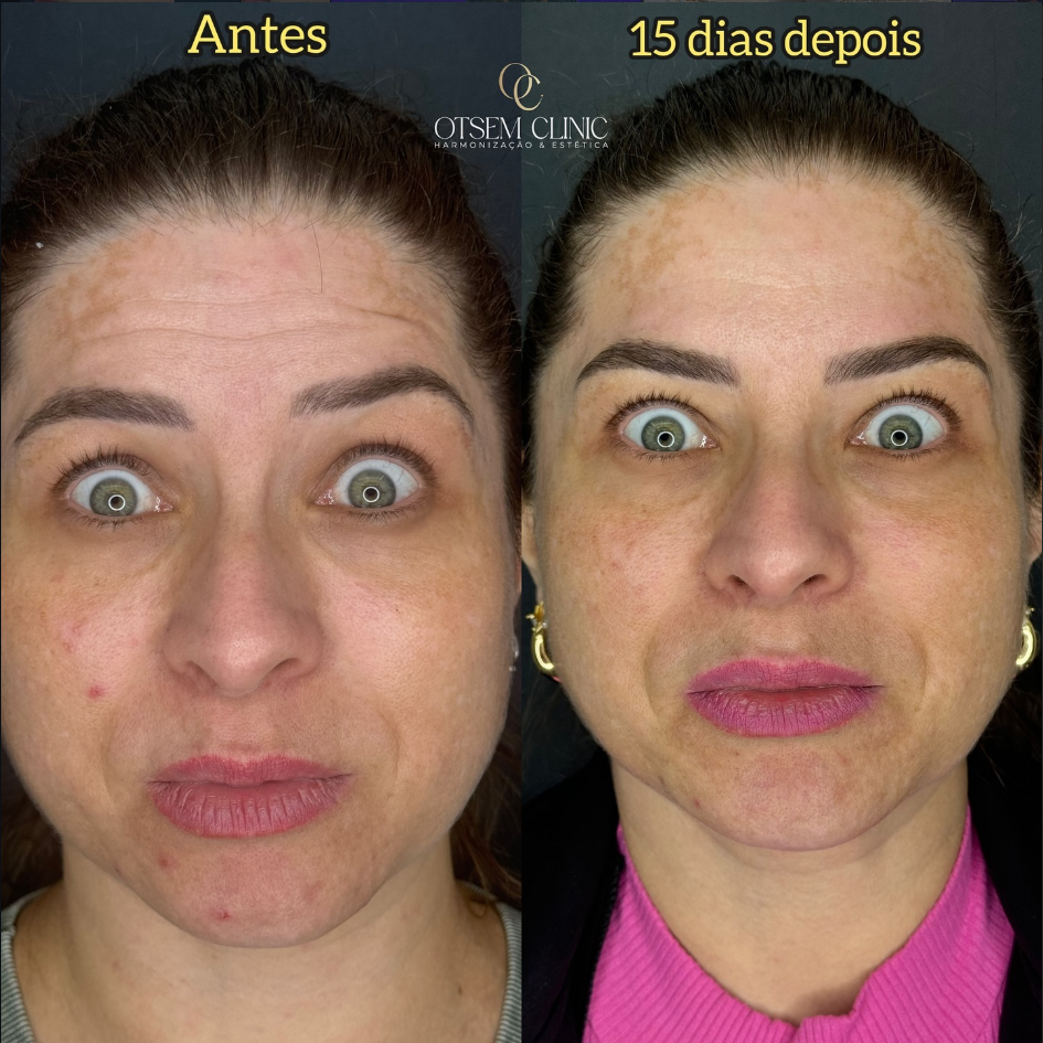 Captura de tela 2026-03-18 152633